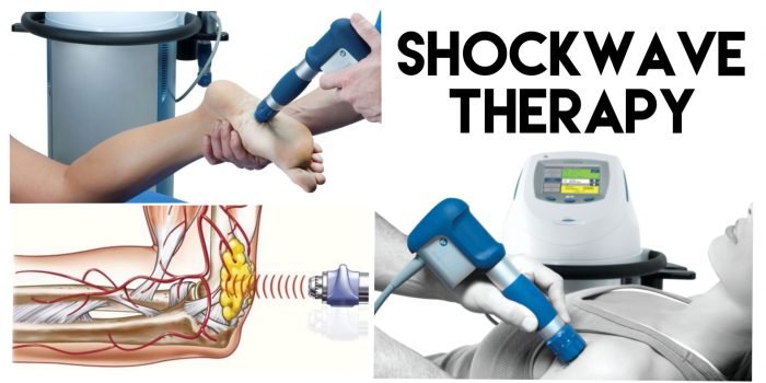 Shockwave Therapy in Burlington – Systematic Review