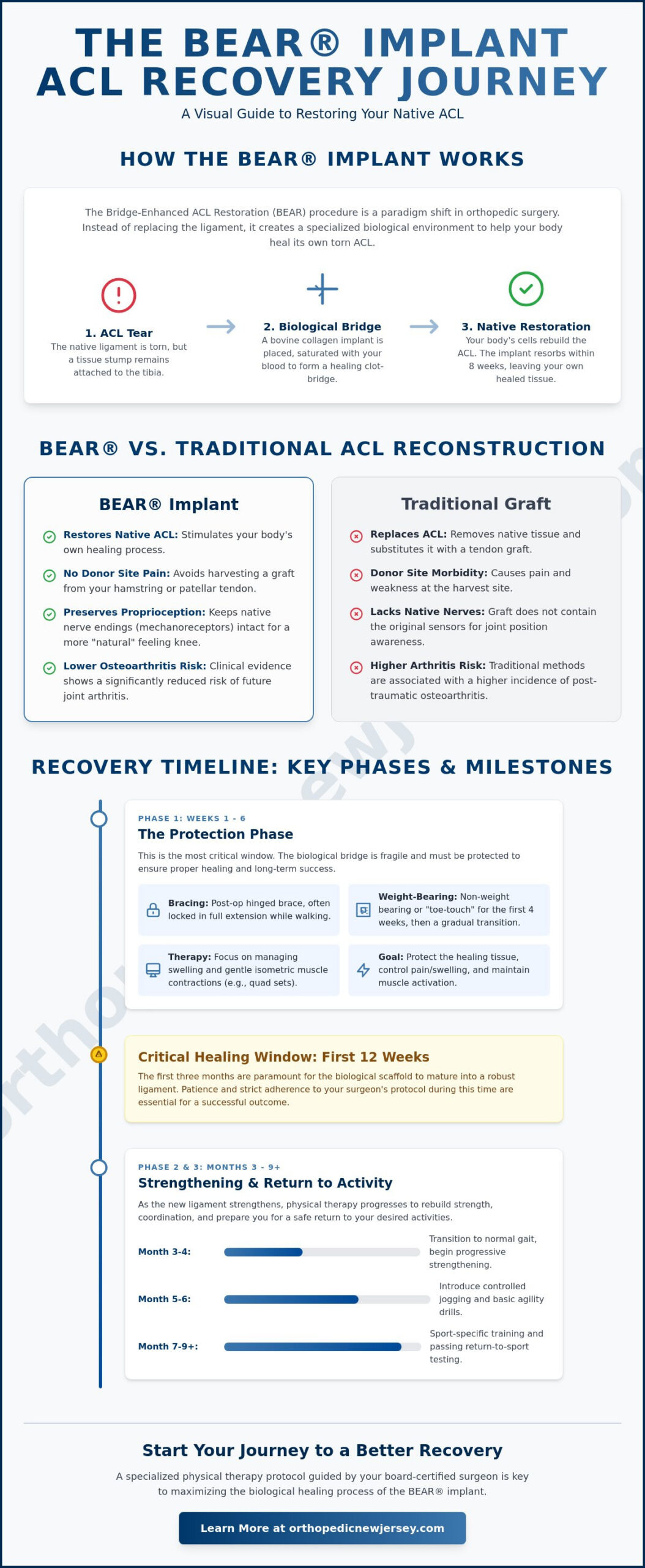 BEAR Implant ACL Recovery: A Comprehensive Month-by-Month Guide