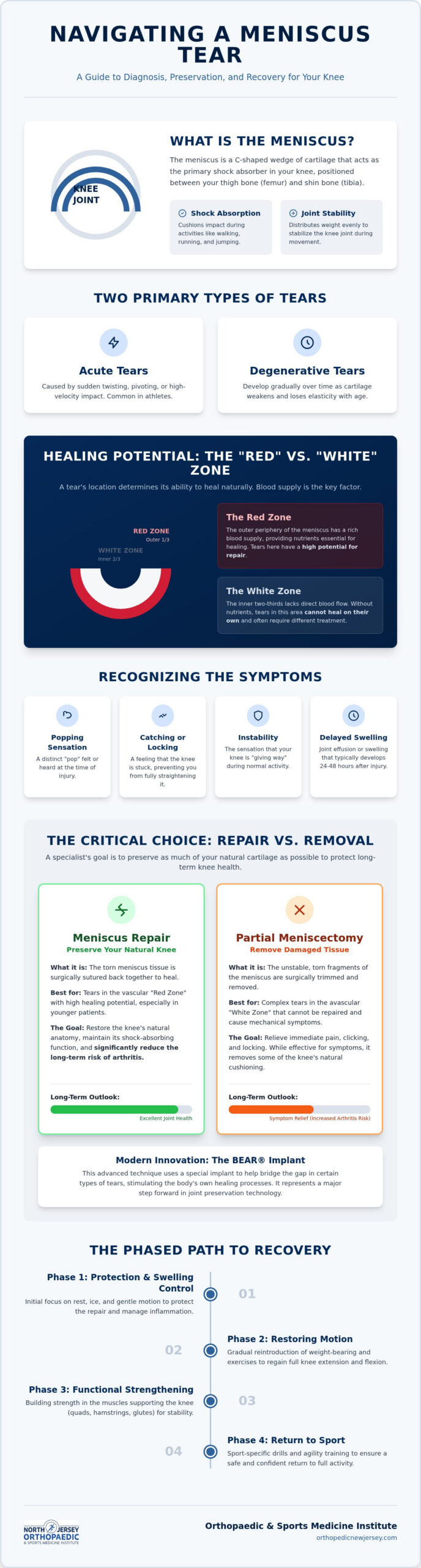 Meniscus Tear Specialist in Nutley, NJ: Advanced Knee Repair & Recovery