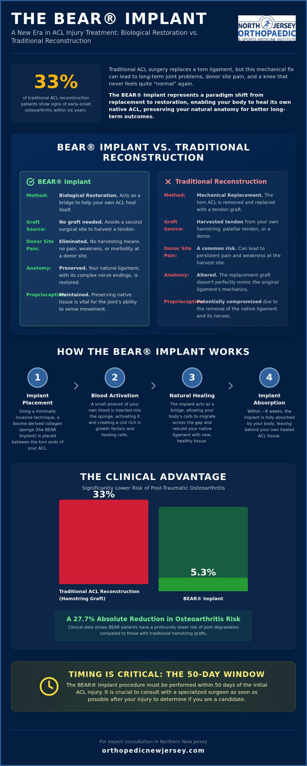 BEAR Implant Surgeon in Clifton, NJ: Advanced ACL Repair and Restoration